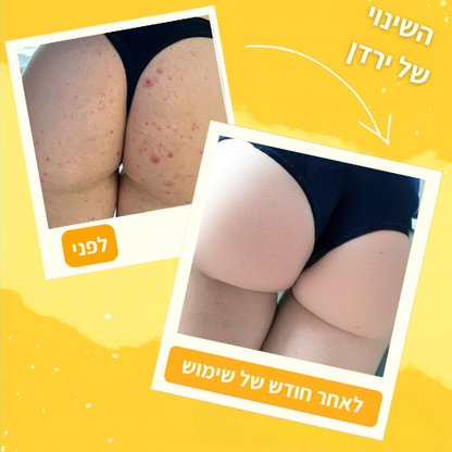 סבון ההבהרה הטבעי של GLOWIN