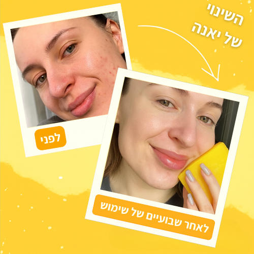 סבון ההבהרה הטבעי של GLOWIN